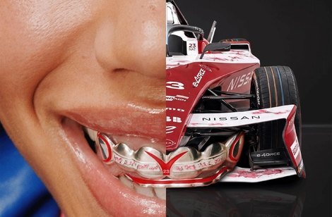 Quand la calandre de la Skyline GT-R devient un étrange bijou pour les dents