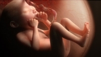 Les foetus affectés par la pollution atmosphérique